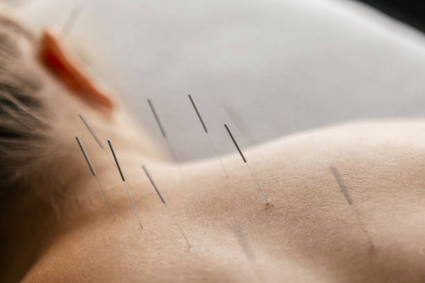 Acupuncture billing team